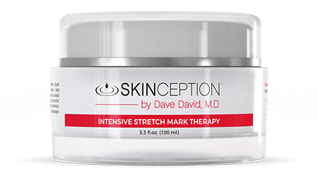skinception-intensive-stretch-mark-therapy-460×260-1 skinception-intensive-stretch-mark-therapy-460×260-1